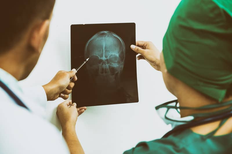 Traumatic Brain Injury Attorney Near Me
