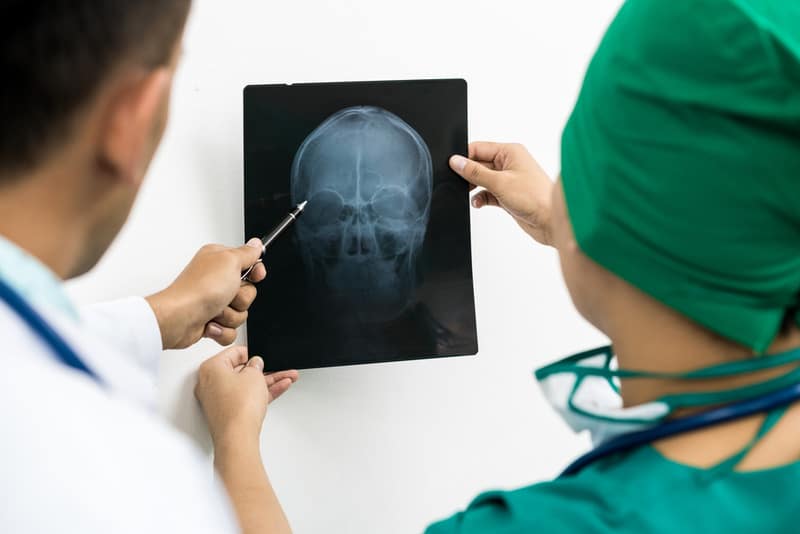 los angeles traumatic brain injury lawyer near me