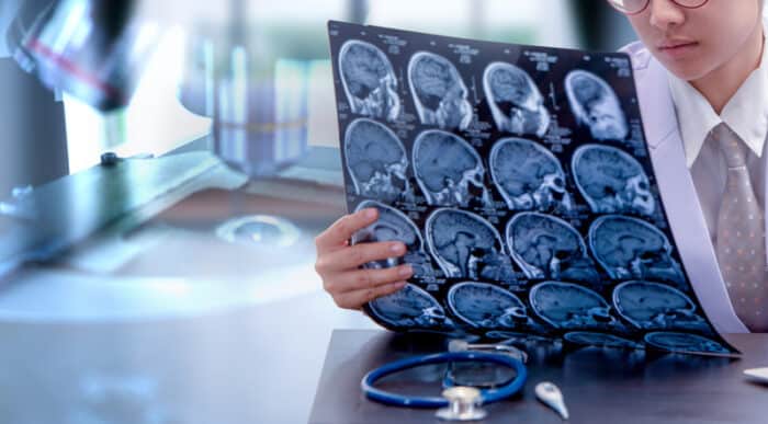 Traumatic Brain Injury In Los Angeles